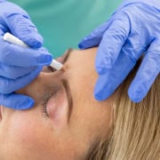 Behandlungsvorbereitung, makieren des Behandlungsareals Botox