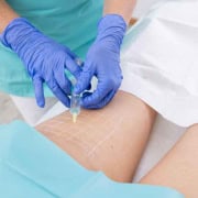 Cellulite Behandlung Freiburg