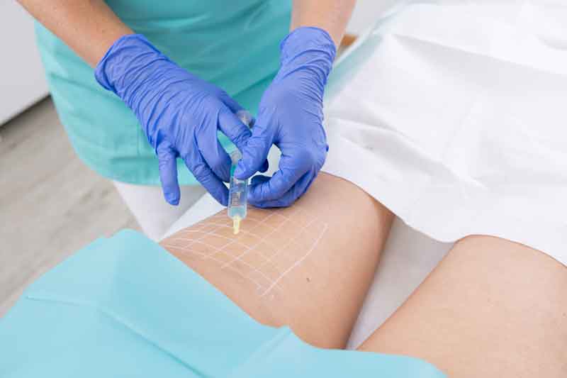 Cellulite Behandlung Freiburg